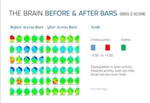 access bars