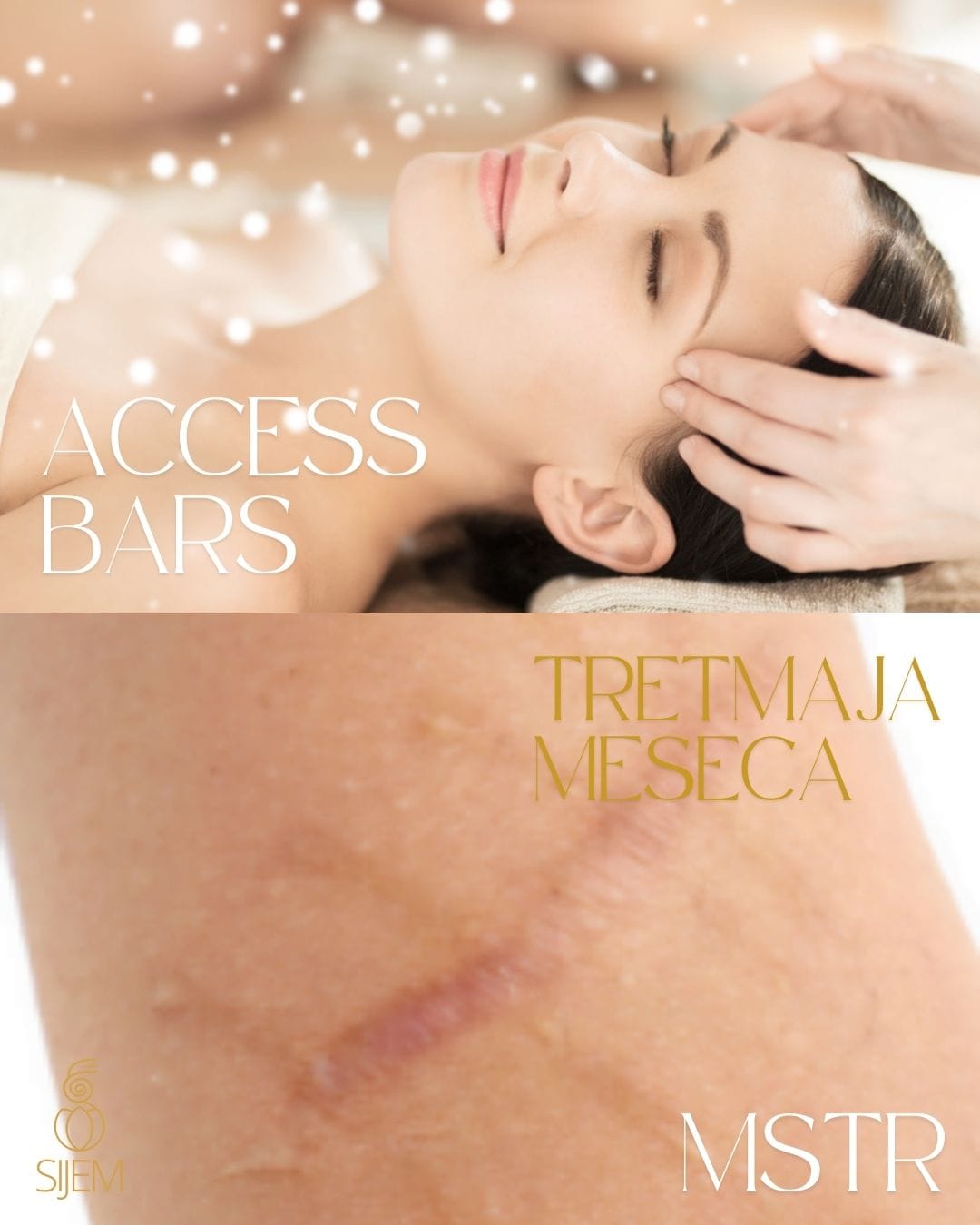 tretma-meseca